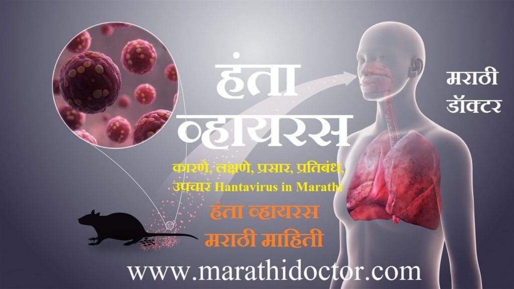 Hantavirus in Marathi, What is Hantavirus in Marathi, Hantavirus information in Marathi, Hantavirus Meaning in Marathi, Hantavirus Causes in Marathi, Hantavirus Symptoms in Marathi, Hantavirus Pulmonary Syndrome in Marathi, Hemorrhagic Fever With Renal Syndrome in Marathi, Hantavirus Spread in Marathi, Hantavirus Diagnosis in Marathi, Hantavirus Treatment in Marathi, हंता व्हायरस कारणे, हंता व्हायरस लक्षणे, हंता व्हायरस प्रसार, हंता व्हायरस प्रतिबंध, हंता व्हायरस उपचार