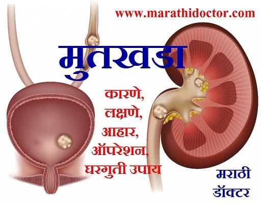 Lollygag Meaning In Marathi - मराठी अर्थ