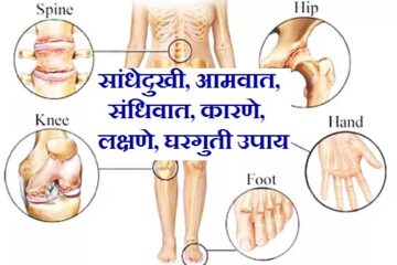 सांधेदुखी, आमवात, संधिवात, Meaning of Arthritis in Marathi, joint pain in marathi, arthritis in marathi, rheumatoid arthritis in marathi, gout in marathi, meaning of gout in marathi, what is gout in marathi, sandhivata in marathi, Symptoms of Sandhivat in Marathi,